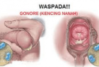 jual obat gonore di bekasi jual obat gonore di bekasi