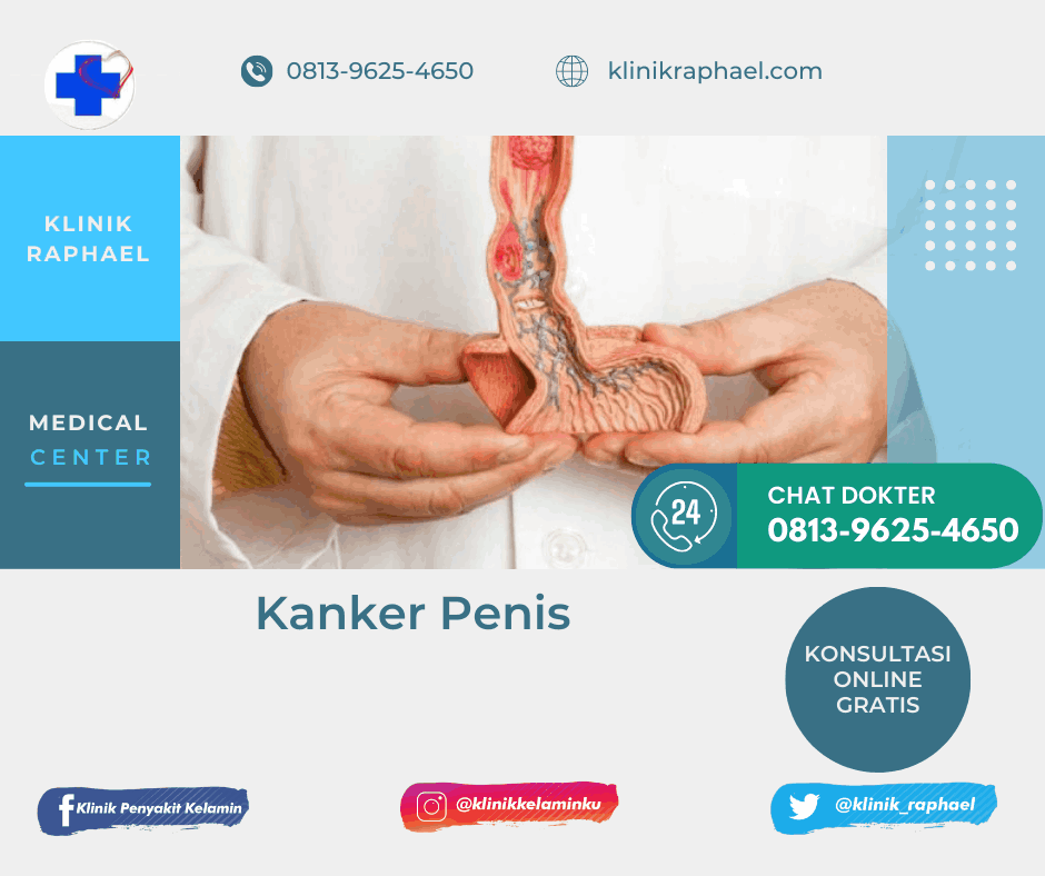 Kanker Penis Kanker Penis