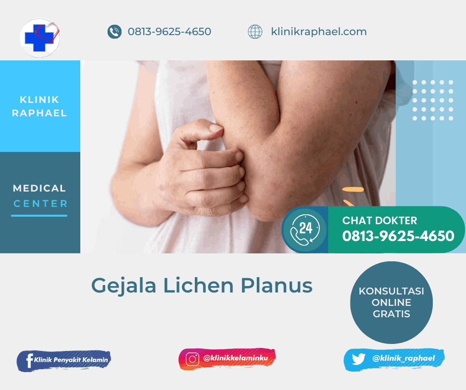 Lichen Planus