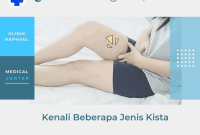 Jenis penyakit kista jenis kista