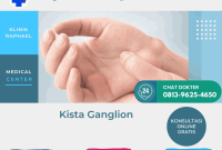 Kista ganglion di tangan kista ganglion