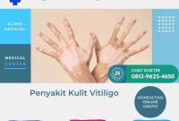 Penyakit kulit vitiligo vitiligo