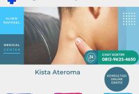 penyakit kista ateroma kista-ateroma