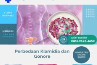 perbedaan klamidia dan gonore perbedaan klamidia dan gonore
