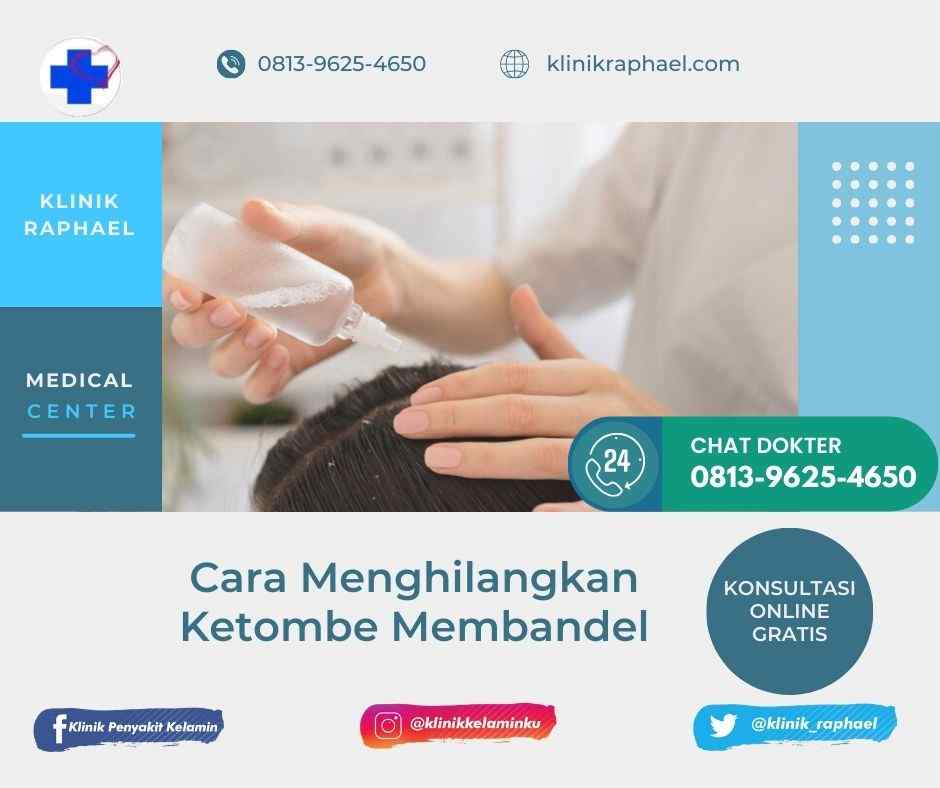 menghilangkan ketombe membandel