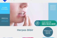 herpes bibir