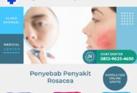penyebab penyakit rosacea