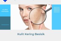 kulit kering bersisik