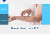 penyebab bercak merah pada kulit