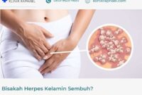 bisakah-herpes-kelamin-sembuh bisakah herpes kelamin disembuhkan