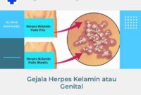 gejala-herpes-kelamin-pria-wanita gejala herpes kelamin pada pria dan wanita