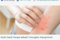 alergi-kulit-gatal kulit gatal akibat alergi