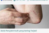 jenis-penyakit-kulit jenis penyakit kulit