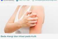 bedanya-alergi-dan-iritasi perbedaan alergi dan iritasi kulit
